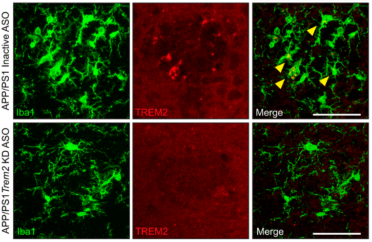 Targeting TREM2 to alter microglial responses